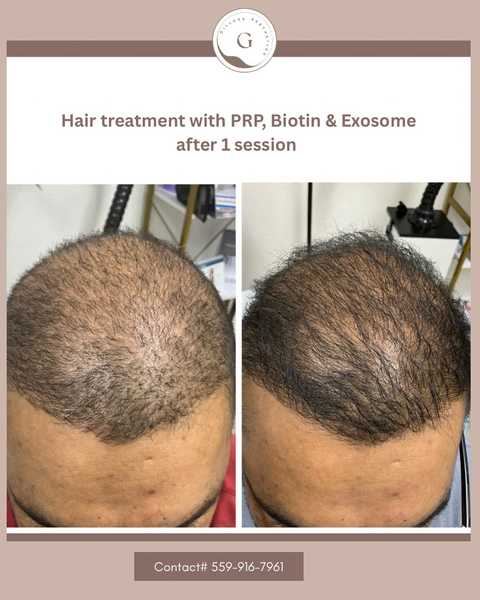 gallery image in our gallery