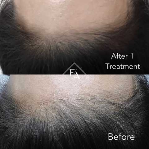 gallery image in our gallery