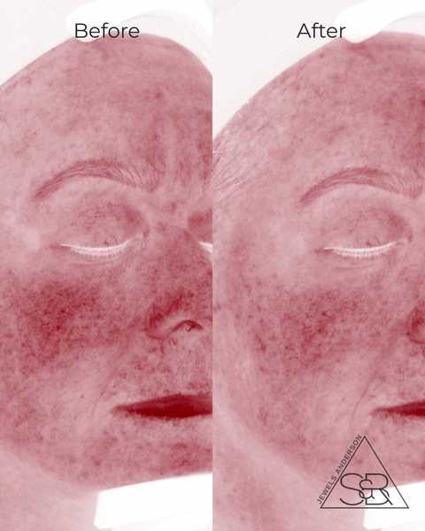 gallery image in our gallery