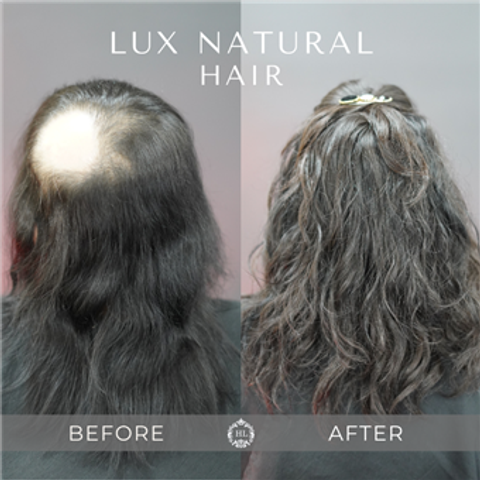 gallery image in our gallery