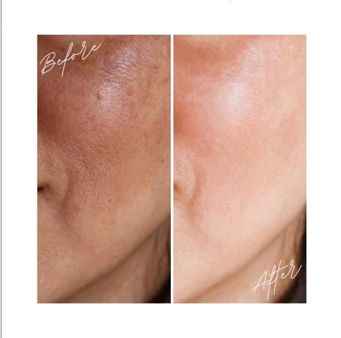skin-care,before-and-after,cosmetic-treatment