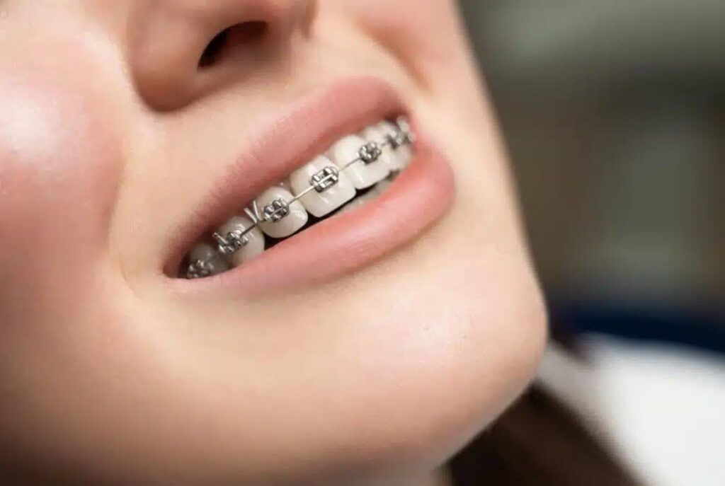 Cosmetic Dentistry