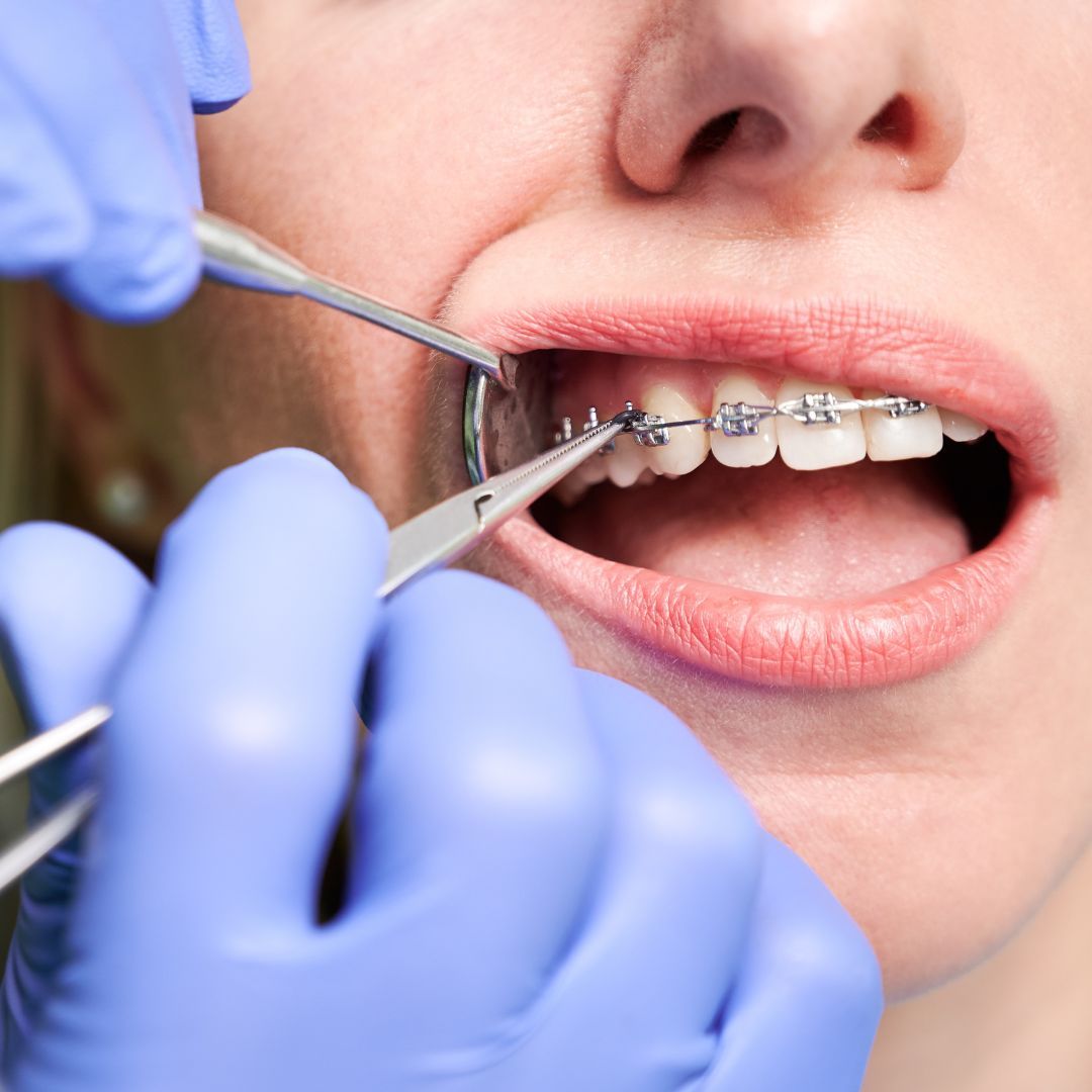 Dental Treatments