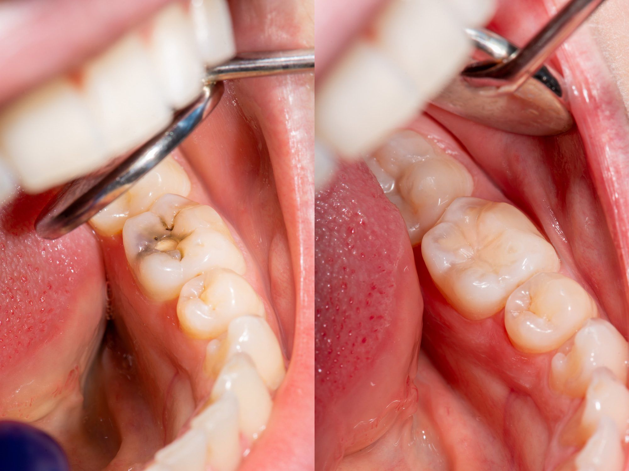 General Dentistry