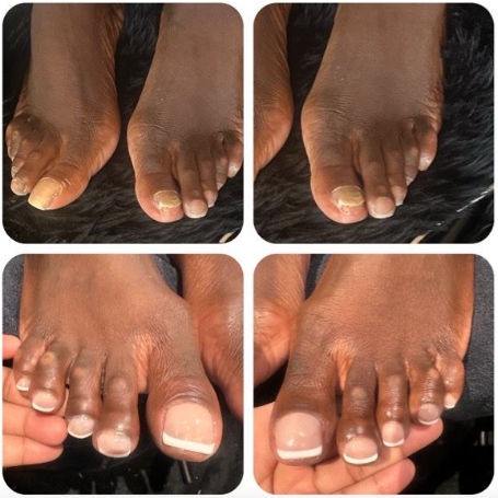 Pedicure Services