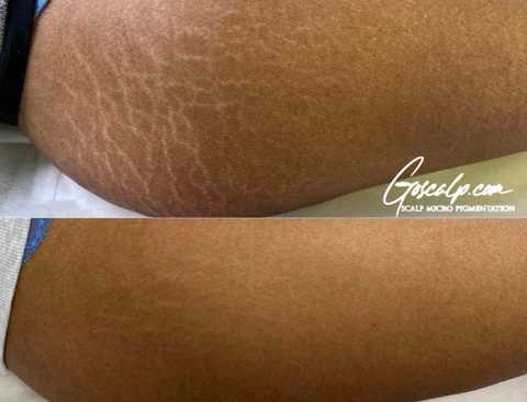 Stretch Mark Cover-up’s
