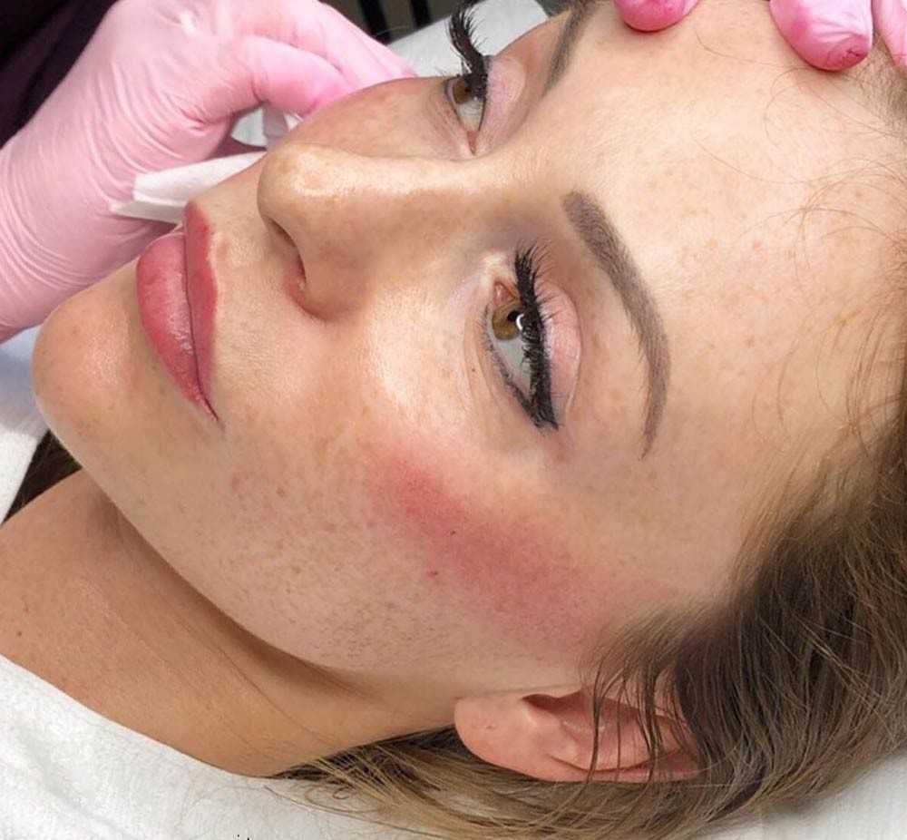 Permanent Cheek Blush