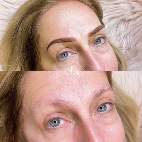 gallery image in our gallery