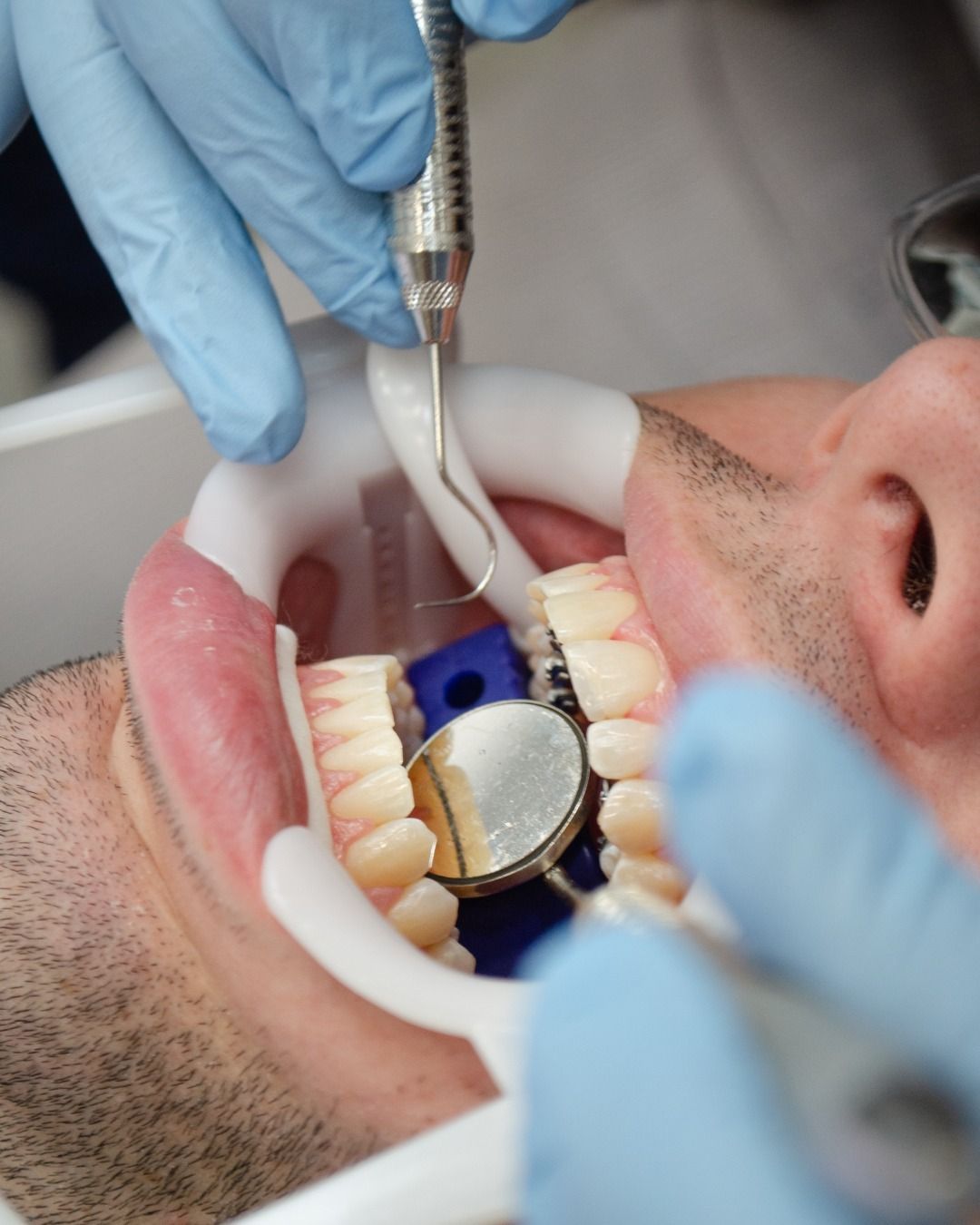 Cosmetic Dentistry