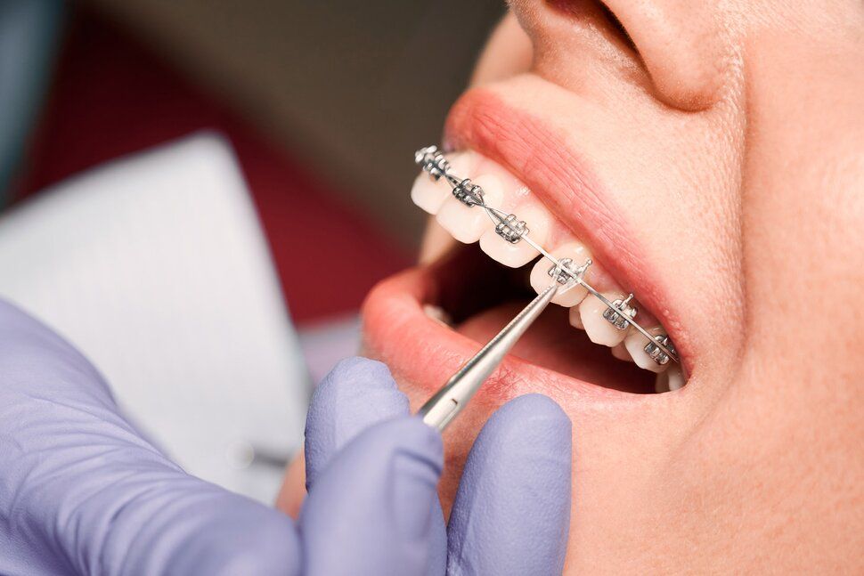 Dental Treatments