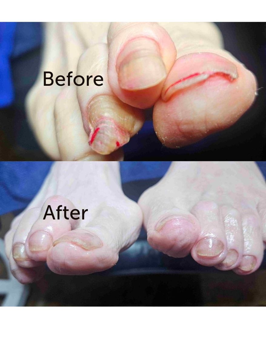 Medical Spa Pedicures