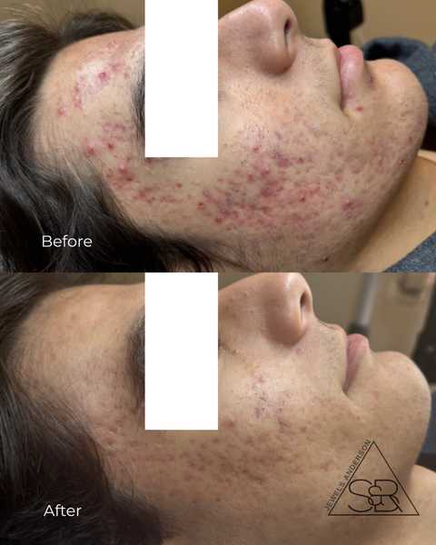 gallery image in our gallery