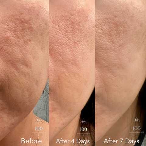 gallery image in our gallery