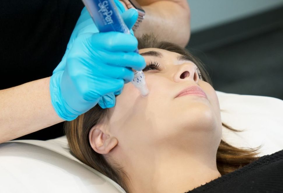 Microneedling