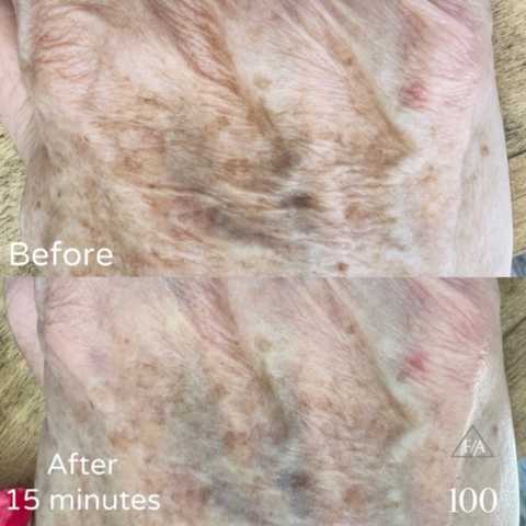 gallery image in our gallery