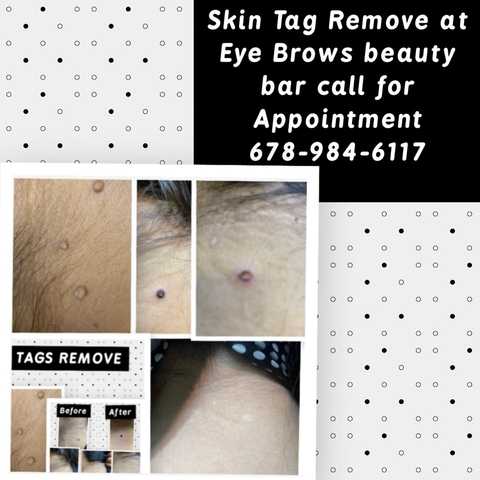 gallery image in our gallery