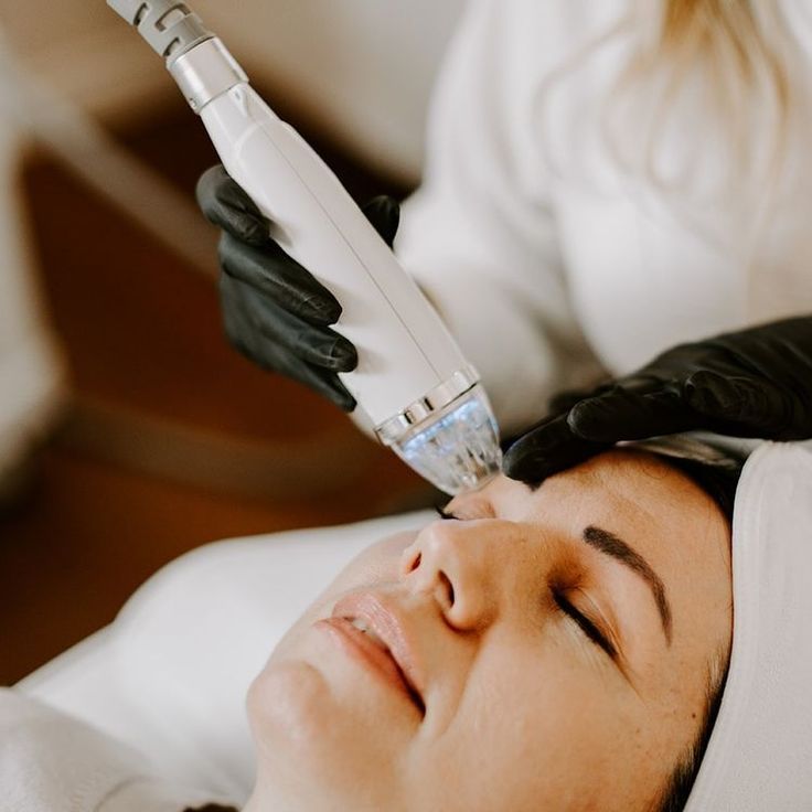 CO2 laser and RF Microneedling