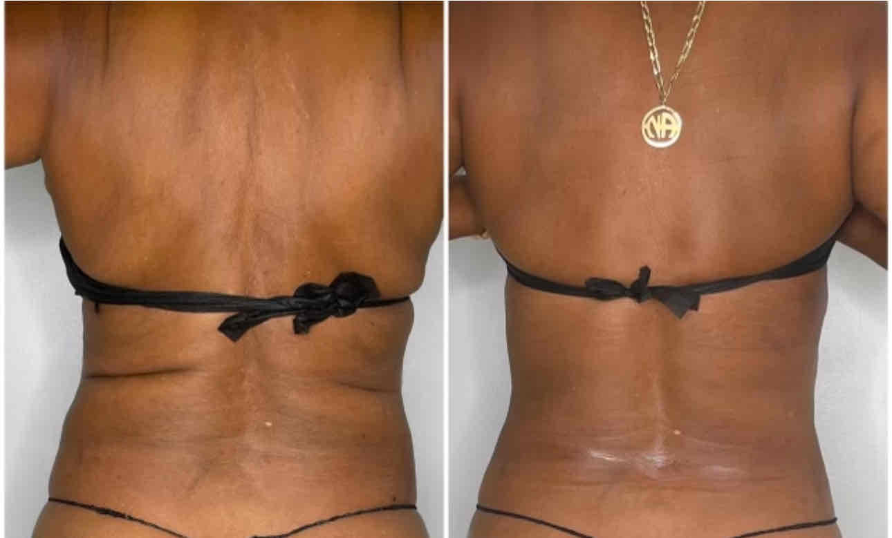  before and after,transformation,skin care,comparison,beauty treatment  