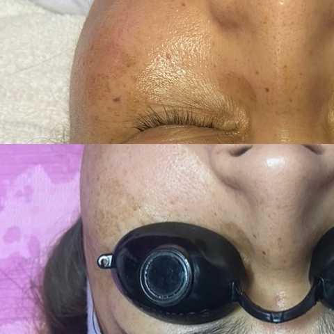 gallery image in our gallery