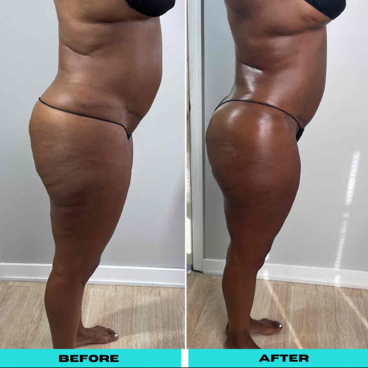  before-after,transformation,body,comparison,wellness  