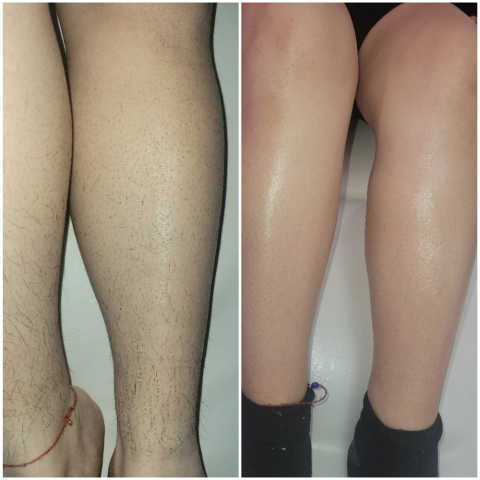 gallery image in our gallery