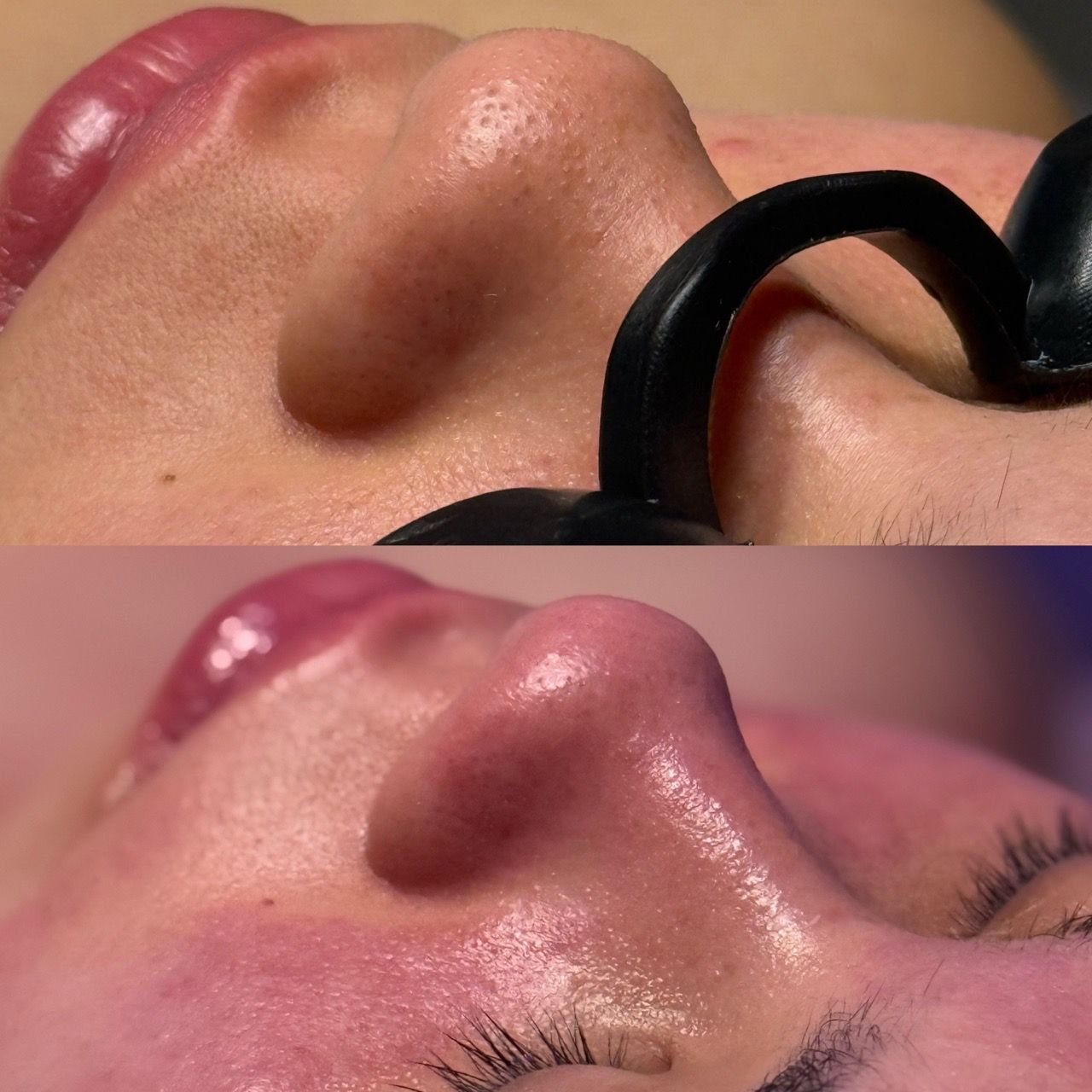  skincare,facial,beauty,treatment,before-and-after  