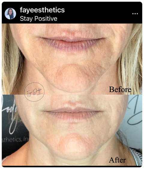 gallery image in our gallery