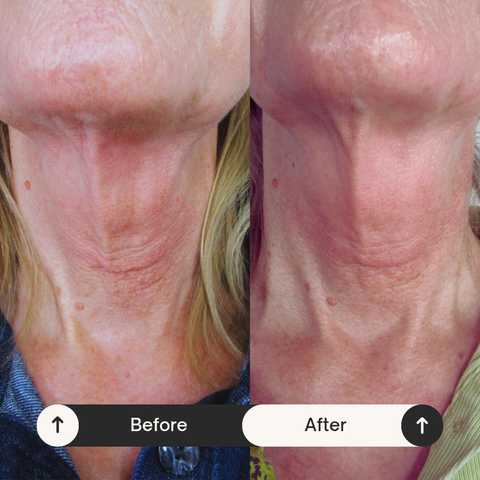 gallery image in our gallery