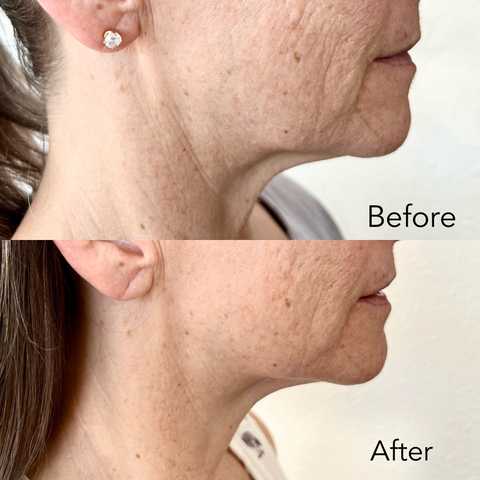 gallery image in our gallery