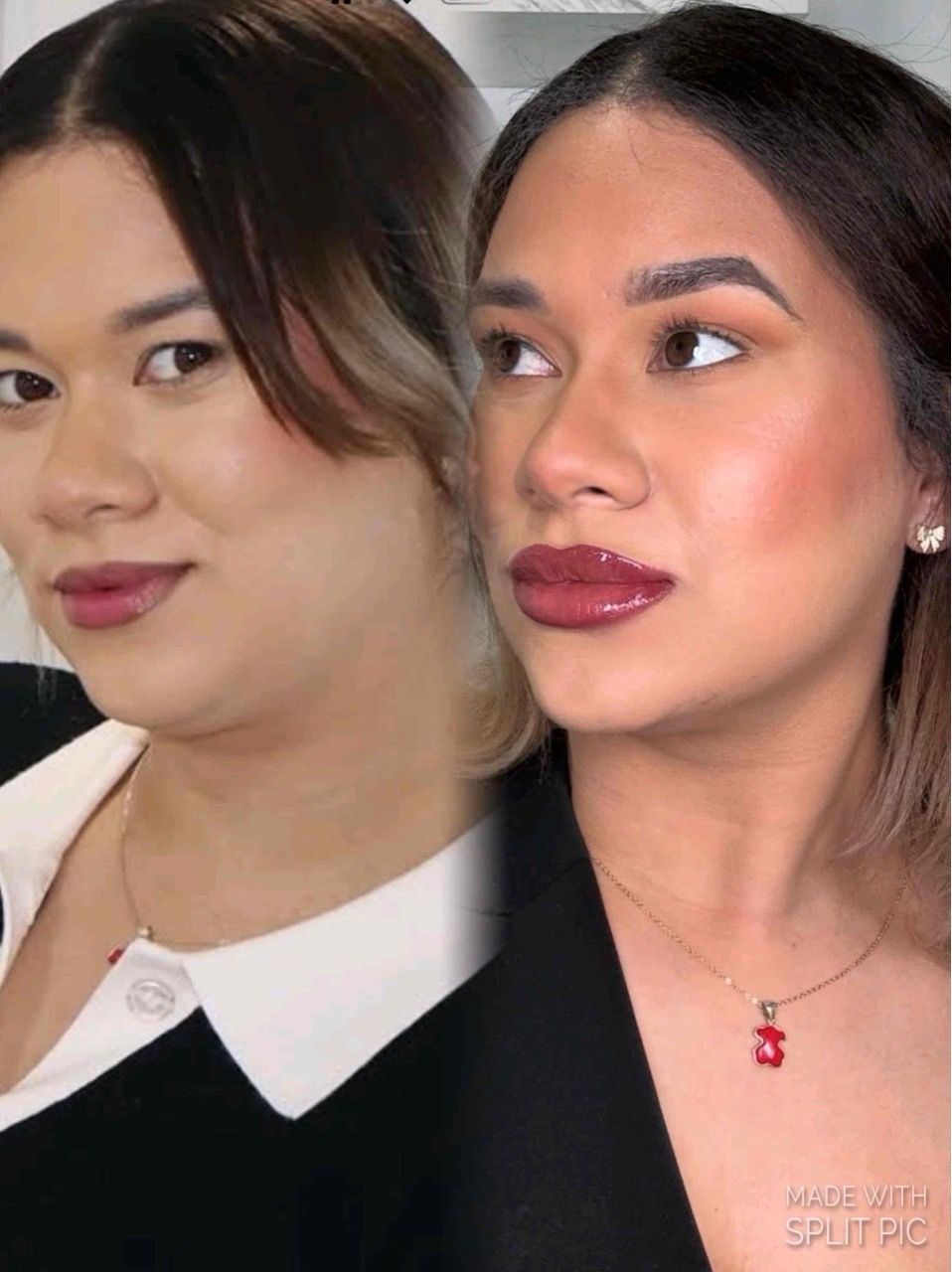 Cosmetic Injectables