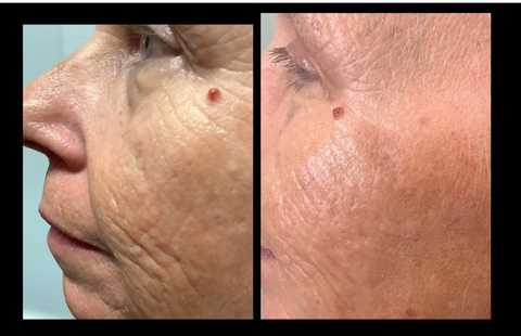 gallery image in our gallery