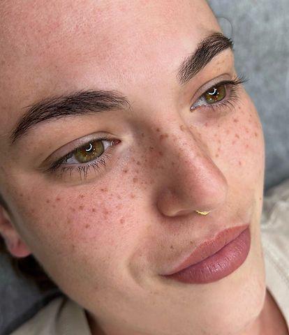 Freckle Tattoo & Beauty Marks