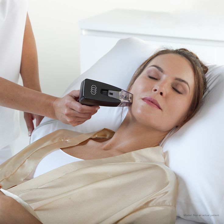 IPL Treatments