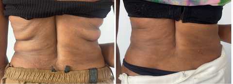 gallery image in our gallery