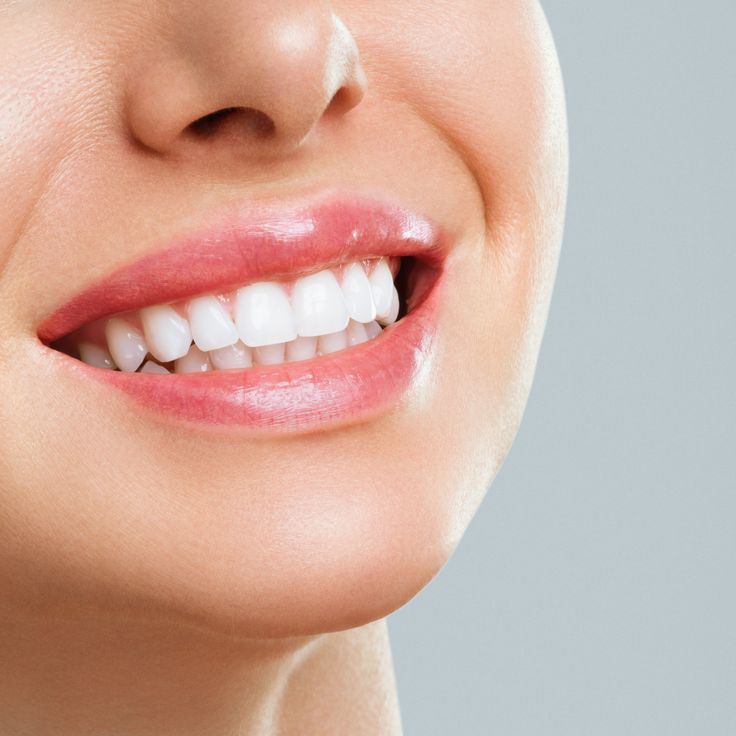 Teeth Whitening