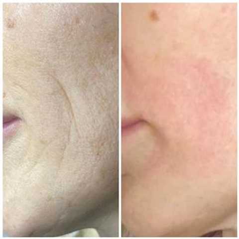 gallery image in our gallery