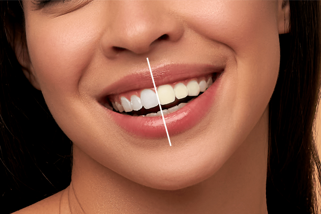 Cosmetic Dentistry