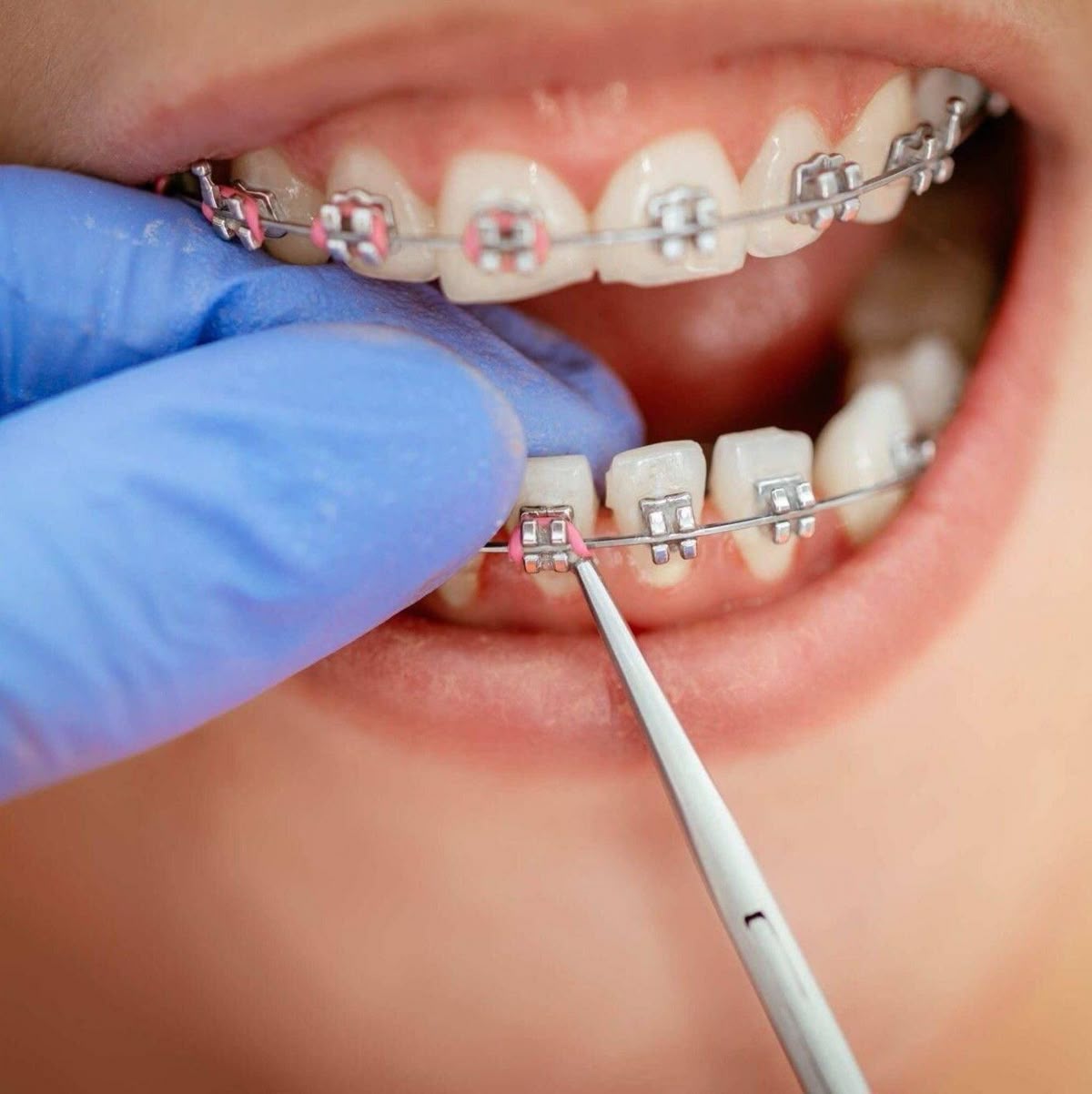 Dental Treatments