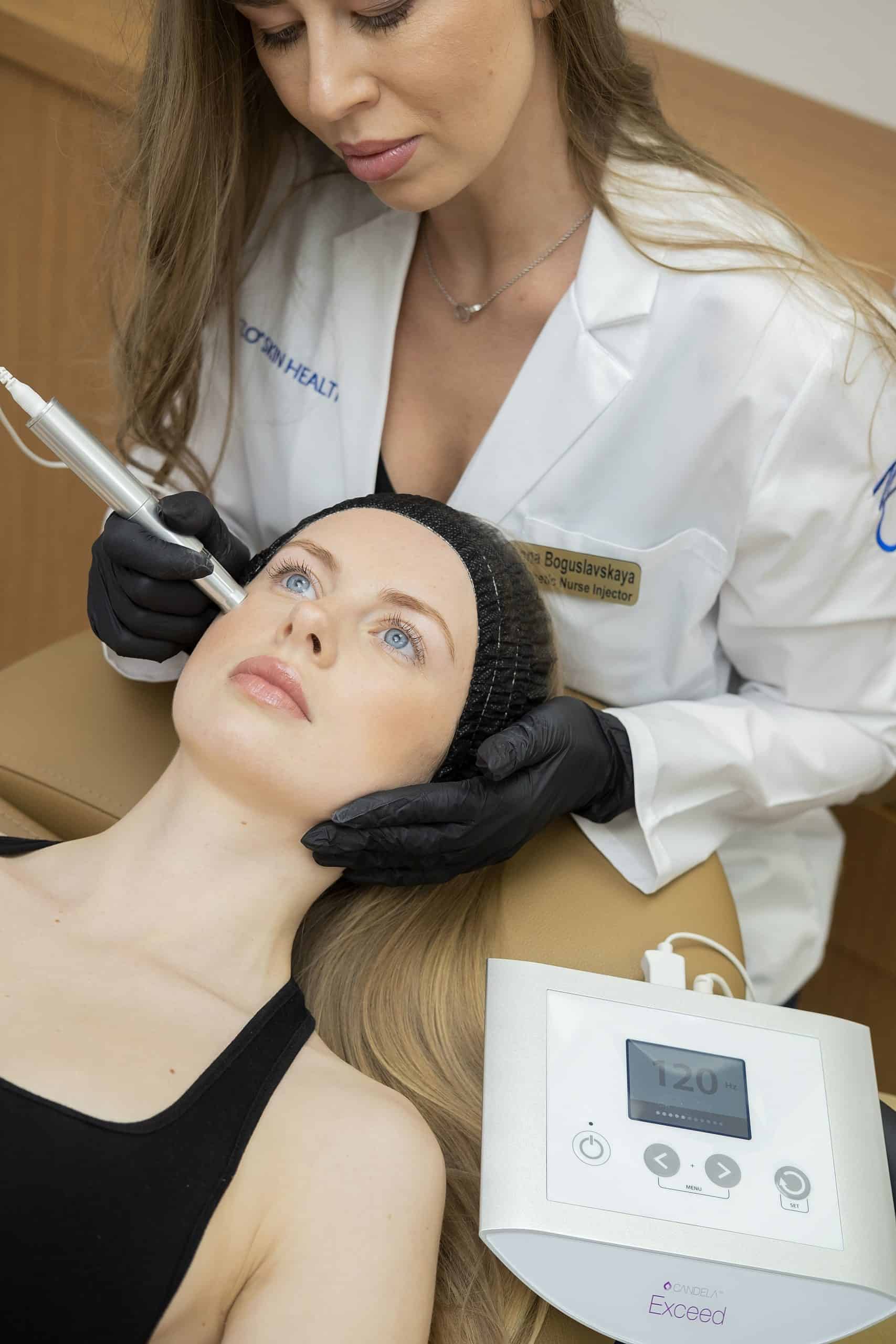 Exceed Microneedling