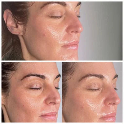  skincare,beauty,facial,glowing skin,healthy skin 