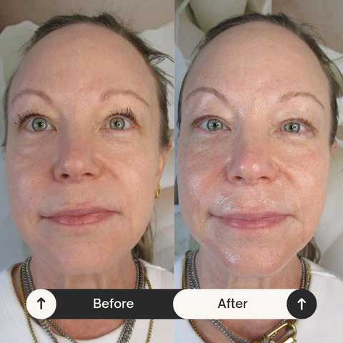 gallery image in our gallery