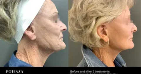 gallery image in our gallery