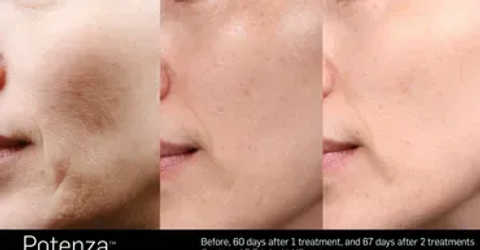 gallery image in our gallery