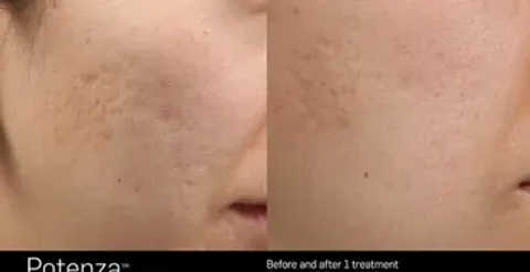 gallery image in our gallery