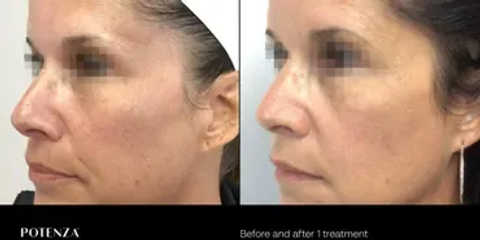 gallery image in our gallery