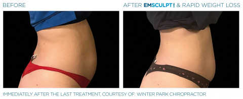 gallery image in our gallery