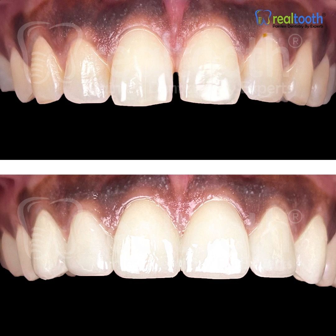  dental,teeth,transformation,before-after,healthcare  