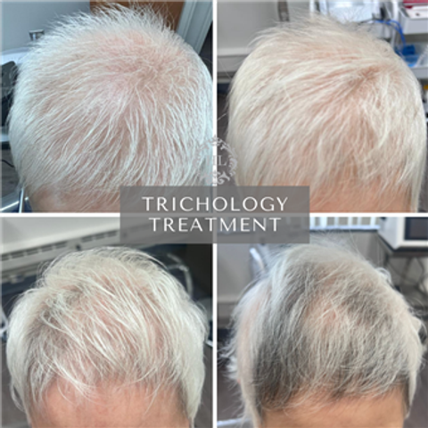 gallery image in our gallery