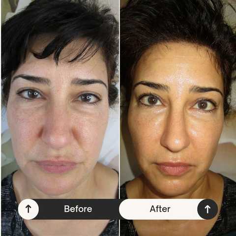 gallery image in our gallery