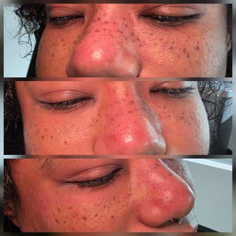 gallery image in our gallery